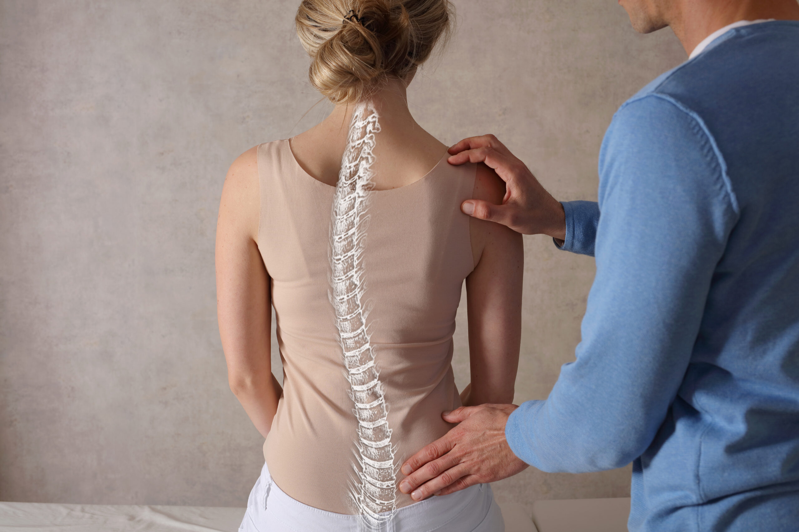 Person with scoliosis spinal curvature needing specialized treatment in Costa Mesa